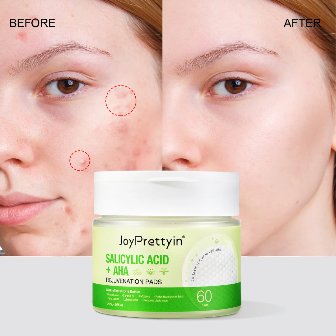 -Cotons imbibés acide salicylique et aha